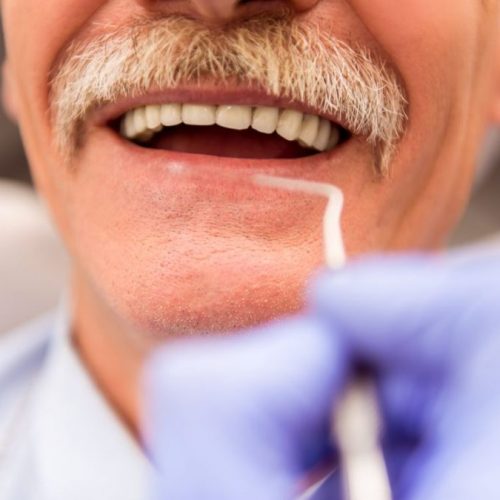 Protesis dental en alfaz del pi