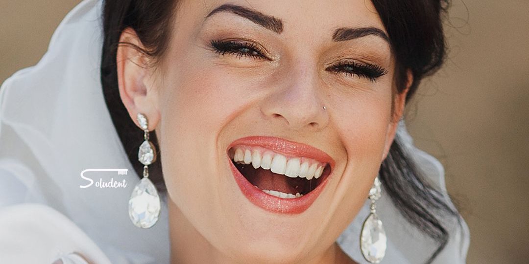 novias estetica dental