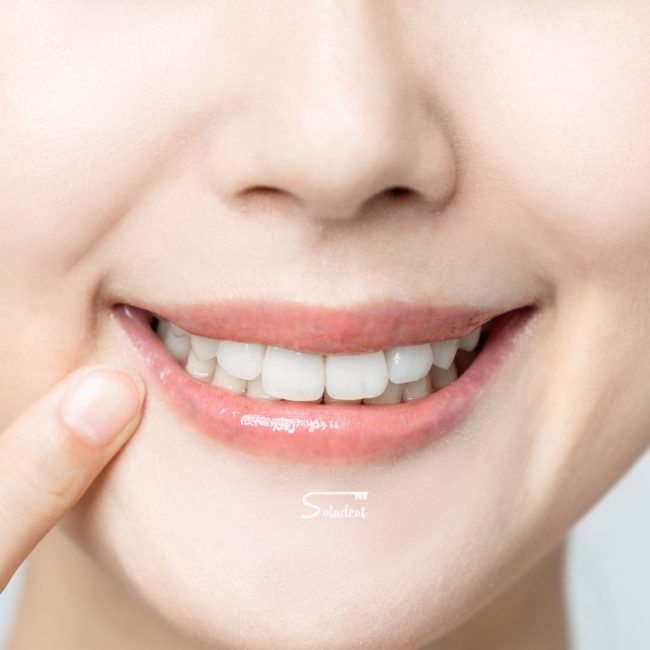 sonrisa perfecta en alfaz del pi