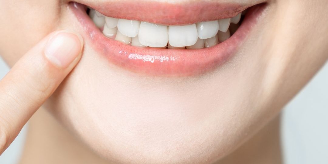 como conseguir la sonrisa perfecta