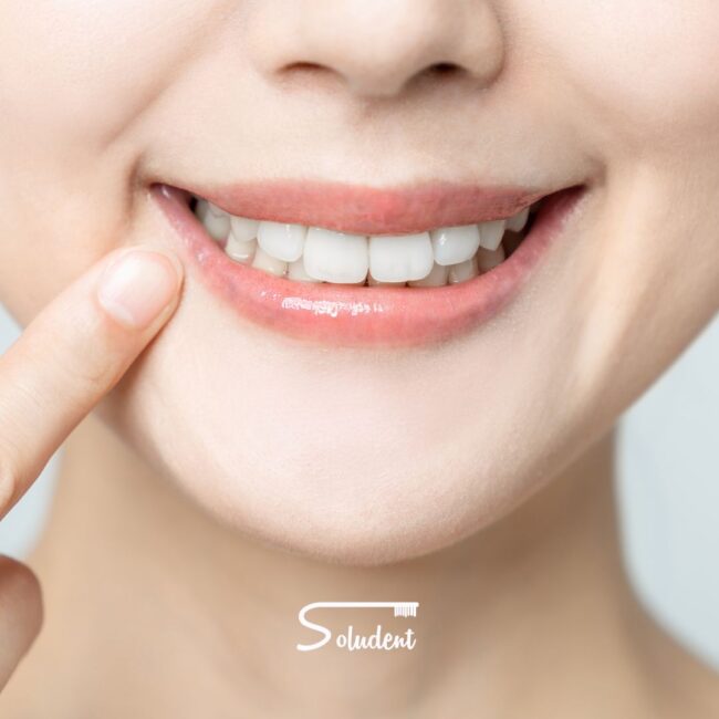 como conseguir la sonrisa perfecta