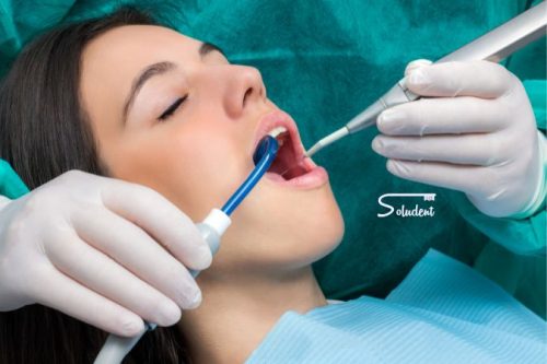 Limpieza dental Alfas del Pi