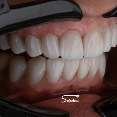 clínica dental soludent