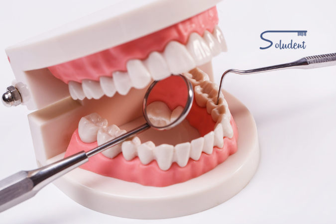 erosión dental en clínica dental soludent