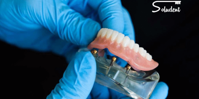 tipo de prótesis dentales en clínica soludent