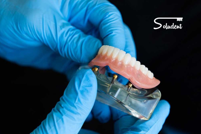 tipo de prótesis dentales en clínica soludent