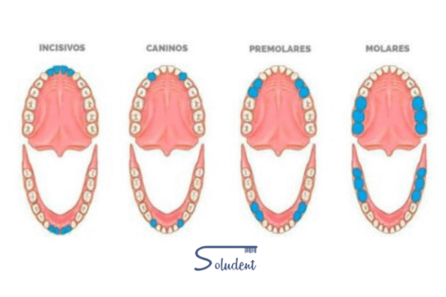 tipos de piezas dentales