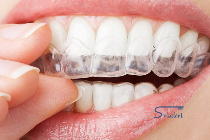 retenedor dental