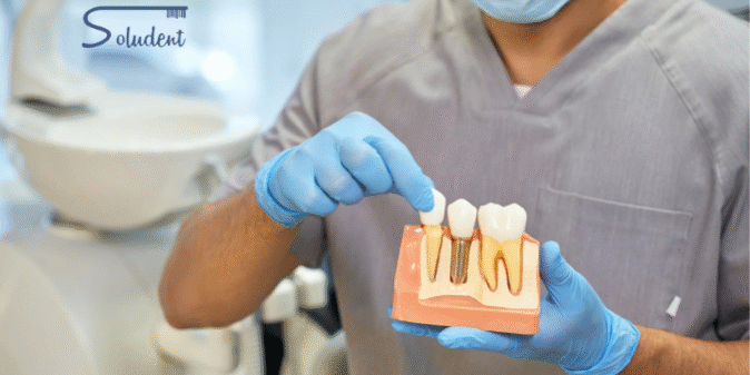 cuidados para un implante dental