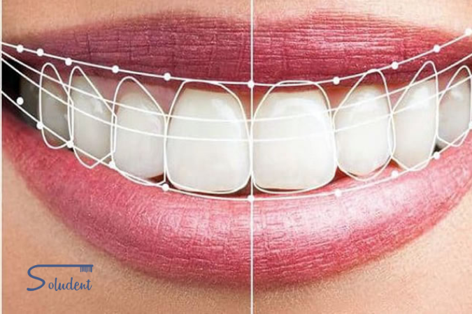 estética dental en Alfaz del Pi