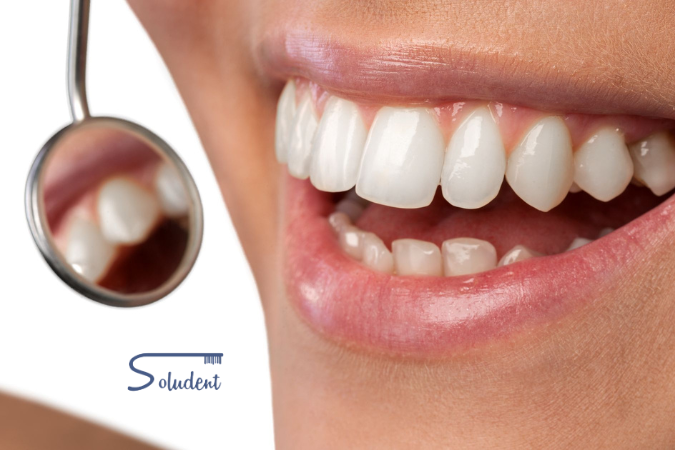 Nombre de los dientes en Alfaz del Pi
