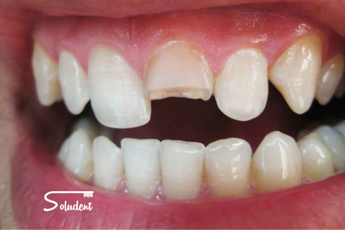 Urgencias Dentales