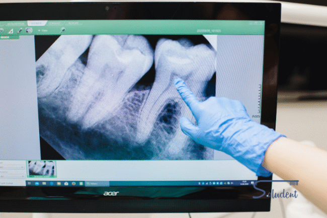 TAC dental en Alfaz del Pí