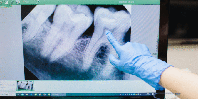 TAC dental en Alfaz del Pí