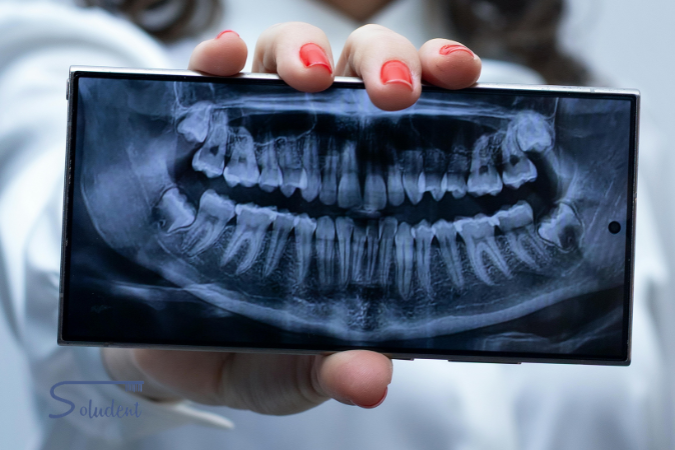 TAC dental en Alfaz del Pí