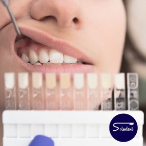 dientes blancos alfaz del pi