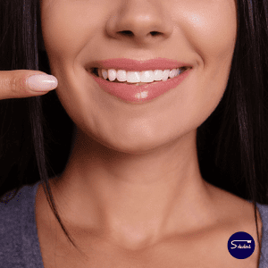 estetica dental dentista