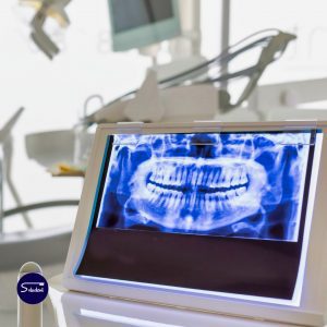 estetica dental alfaz