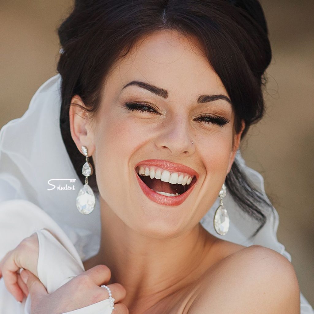 novias estetica dental