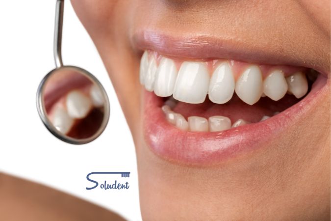 Datos curiosos de los dientes