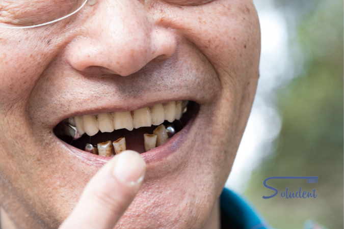 tratamiento falta de dientes en soludent