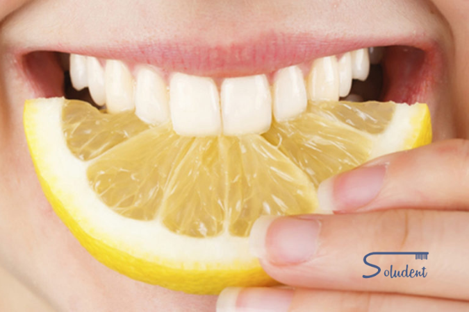 alimentos que causan erosión dental soludent