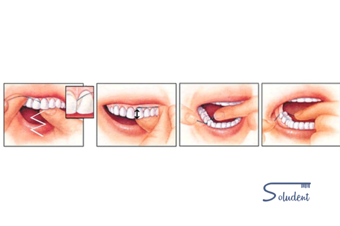 pasos a seguir hilo dental