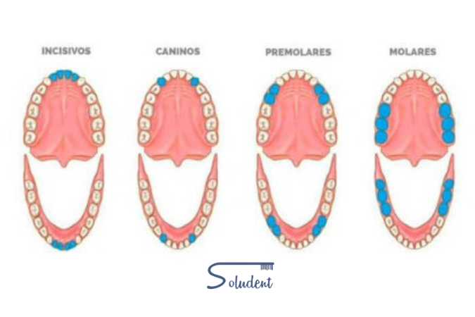 tipos de piezas dentales