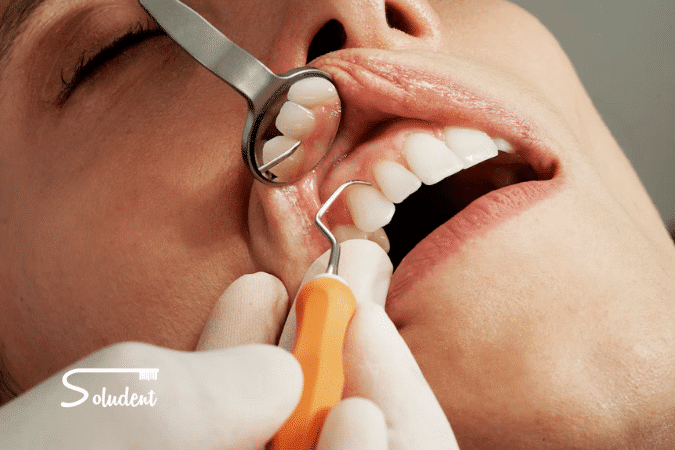Helicobacter pylori en la boca soludent