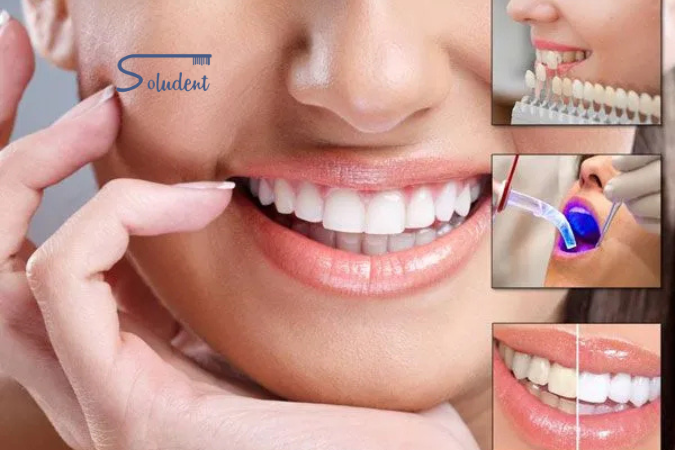 estética dental en Alfaz del Pi