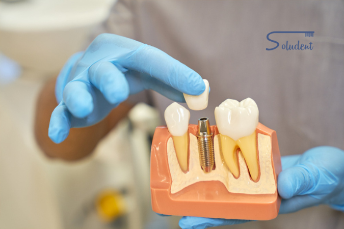 Implantes dentales en Alfaz del Pí