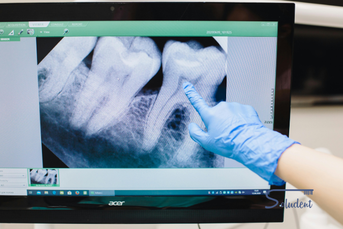 TAC dental en Alfaz del Pí